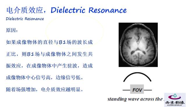 【PPT】磁共振常见伪影及对策