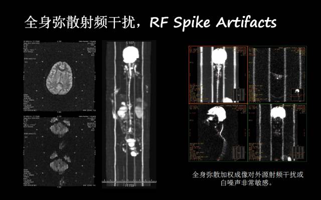 【PPT】磁共振常见伪影及对策