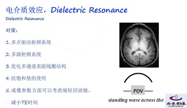 【PPT】磁共振常见伪影及对策