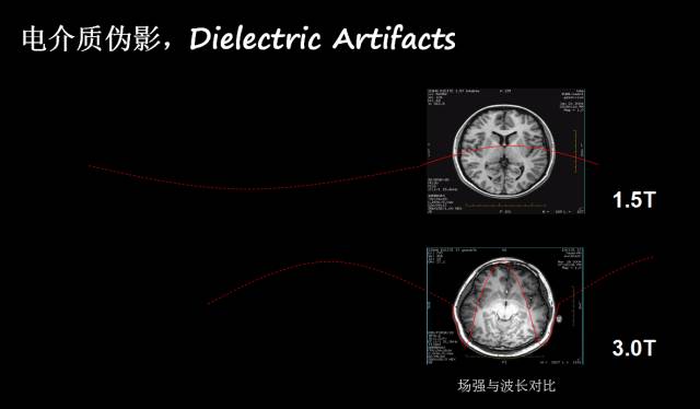 【PPT】磁共振常见伪影及对策
