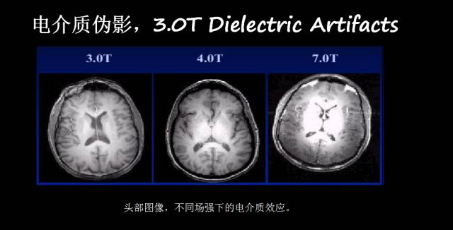 【PPT】磁共振常见伪影及对策