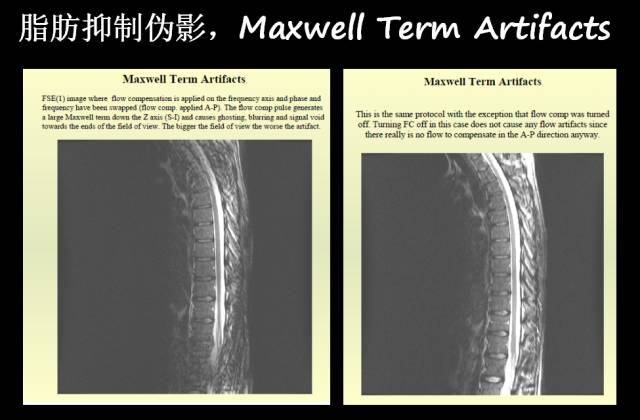 【PPT】磁共振常见伪影及对策