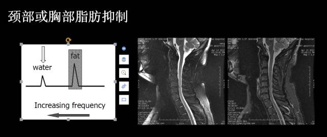 【PPT】磁共振常见伪影及对策