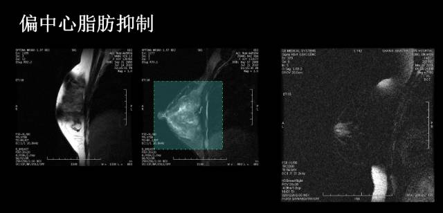 【PPT】磁共振常见伪影及对策