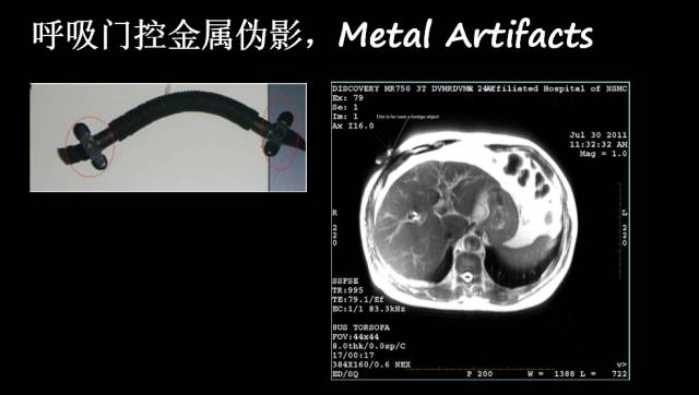 【PPT】磁共振常见伪影及对策