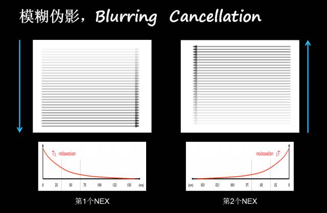 【PPT】磁共振常见伪影及对策