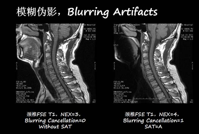 【PPT】磁共振常见伪影及对策