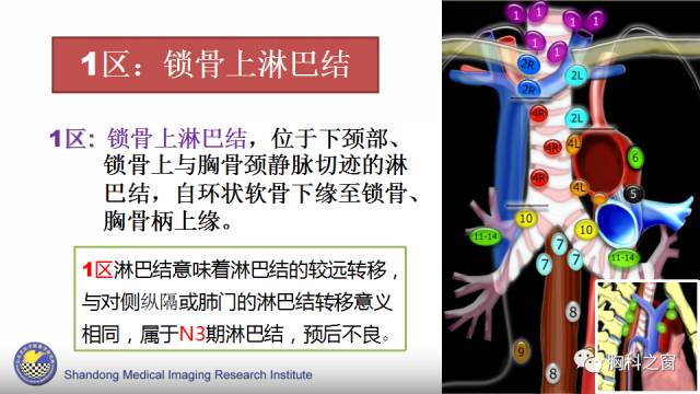 【PPT】胸内(纵膈)淋巴结分区速记