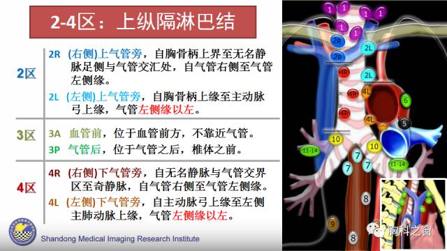 【PPT】胸内(纵膈)淋巴结分区速记