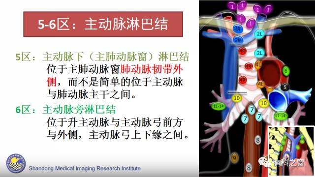 【PPT】胸内(纵膈)淋巴结分区速记