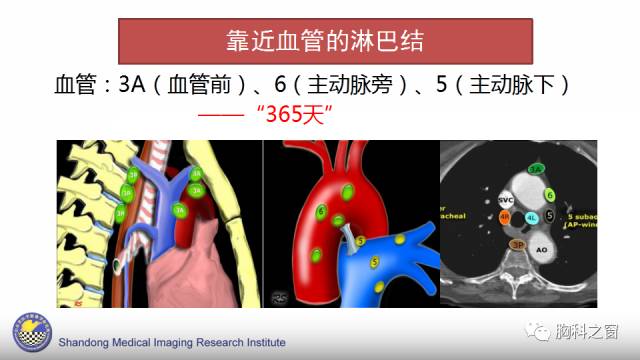 【PPT】胸内(纵膈)淋巴结分区速记