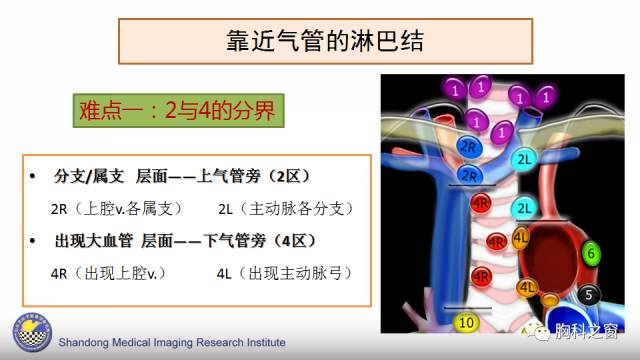 【PPT】胸内(纵膈)淋巴结分区速记