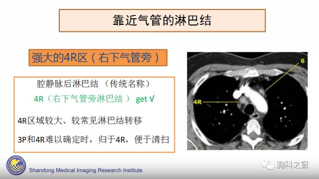 【PPT】胸内(纵膈)淋巴结分区速记