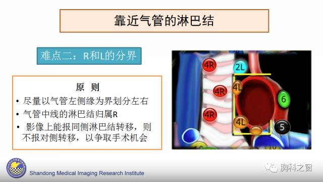 【PPT】胸内(纵膈)淋巴结分区速记