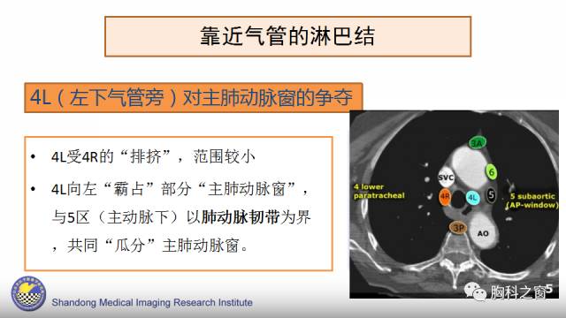 【PPT】胸内(纵膈)淋巴结分区速记