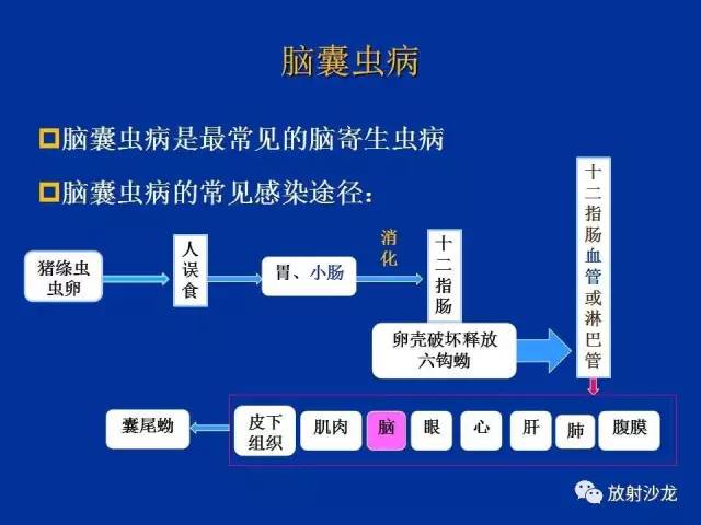 【PPT】脑囊虫病