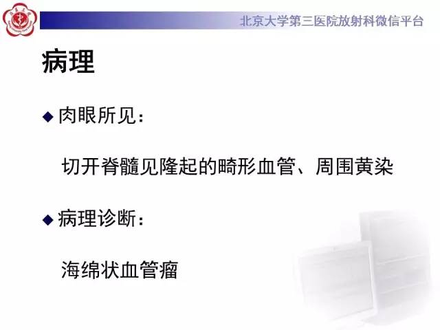 【病例】颈髓海绵状血管瘤1例MR影像表现