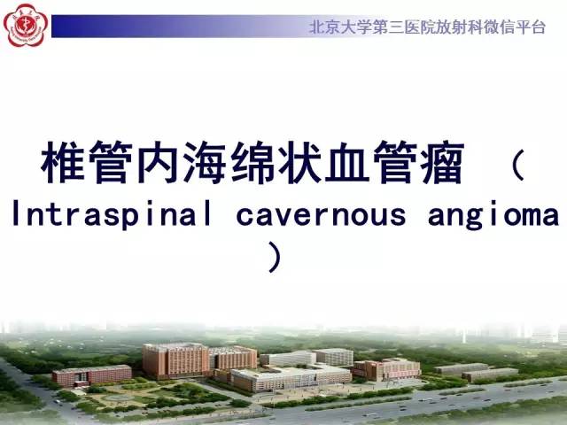 【病例】颈髓海绵状血管瘤1例MR影像表现