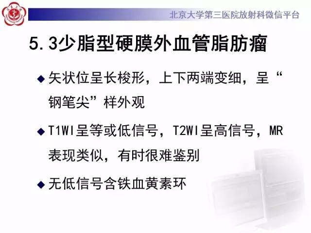【病例】颈髓海绵状血管瘤1例MR影像表现