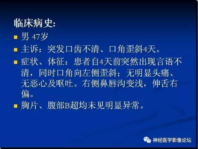 【病例】左颞叶胶质肉瘤1例CT及MR影像表现