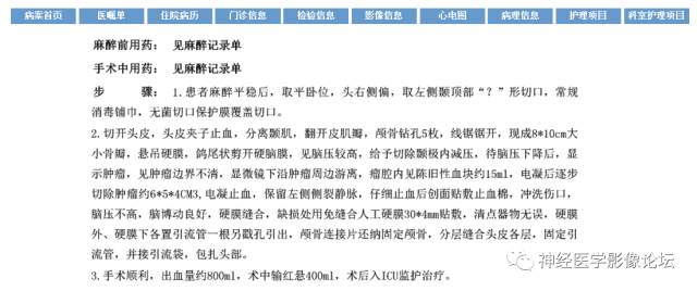 【病例】左颞叶胶质肉瘤1例CT及MR影像表现 【病例】左颞叶胶质肉瘤1例CT及MR影像表现
