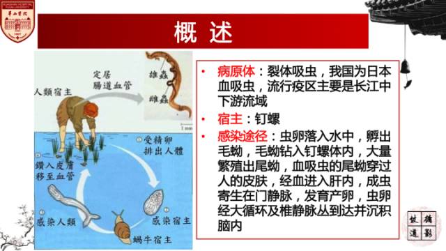 【病例】脑血吸虫性肉芽肿1例MR