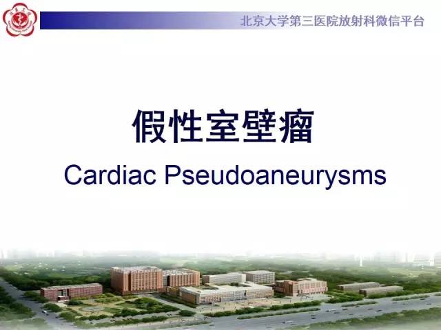 【病例】假性室壁瘤1例MR影像表现