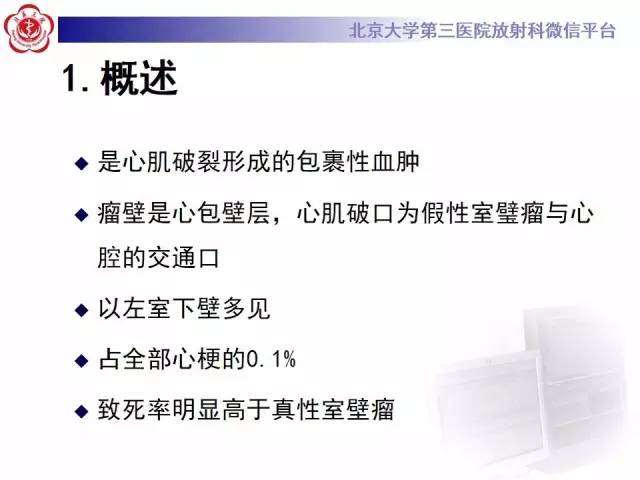 【病例】假性室壁瘤1例MR影像表现