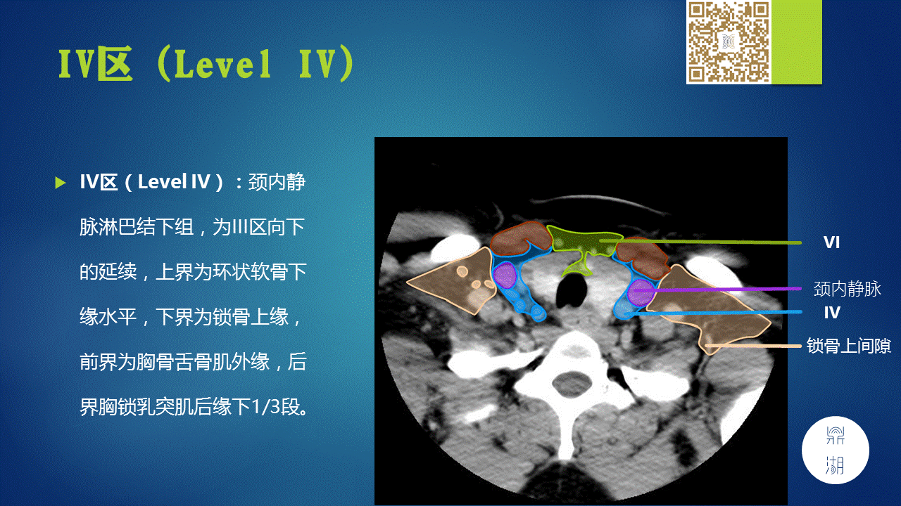 【PPT】颈部淋巴结分区