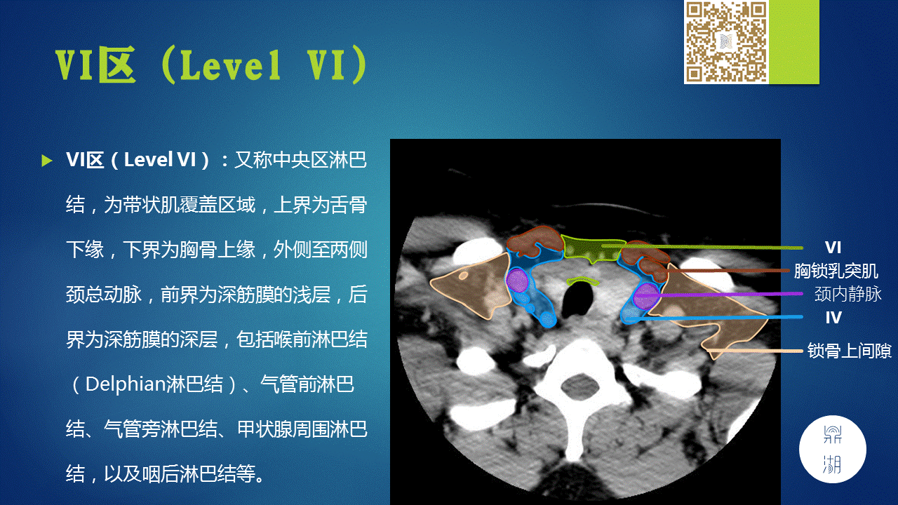 【PPT】颈部淋巴结分区