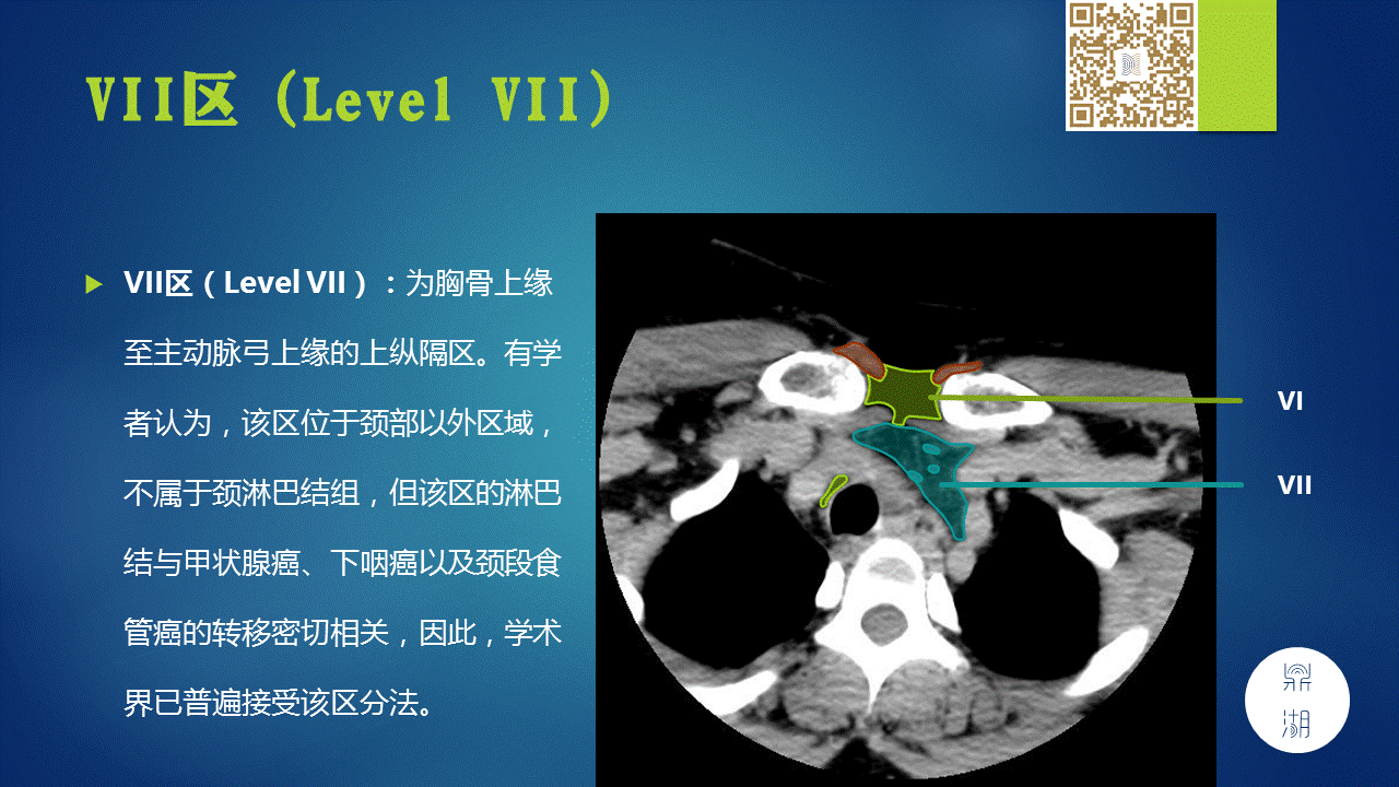 【PPT】颈部淋巴结分区