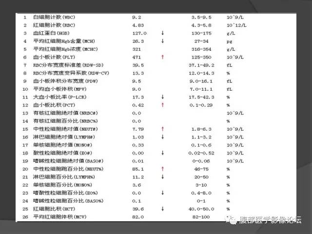 【病例】回肠、盲肠及阑尾结核1例CT 【病例】回肠、盲肠及阑尾结核1例CT