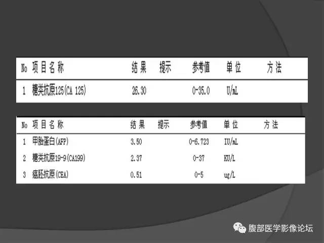 【病例】回肠、盲肠及阑尾结核1例CT 【病例】回肠、盲肠及阑尾结核1例CT