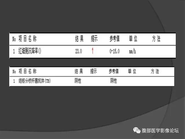 【病例】回肠、盲肠及阑尾结核1例CT 【病例】回肠、盲肠及阑尾结核1例CT