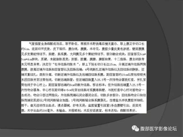 【病例】回肠、盲肠及阑尾结核1例CT 【病例】回肠、盲肠及阑尾结核1例CT