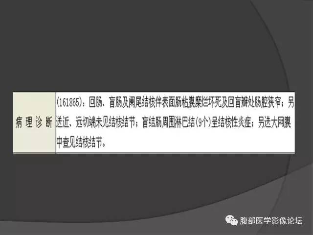 【病例】回肠、盲肠及阑尾结核1例CT 【病例】回肠、盲肠及阑尾结核1例CT