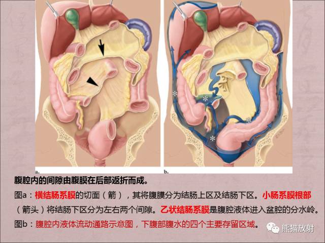 【PPT】腹膜腔继发性肿瘤及肿瘤样病变影像表现