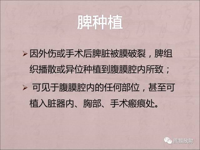 【PPT】腹膜腔继发性肿瘤及肿瘤样病变影像表现