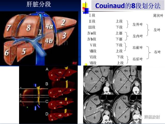 【解剖】上腹部CT断层 [双语]（肝脏解剖及肝段分布、腹部淋巴结分布）