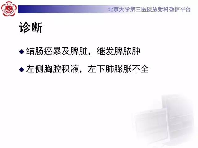 【病例】结肠癌继发脾脏脓肿1例CT