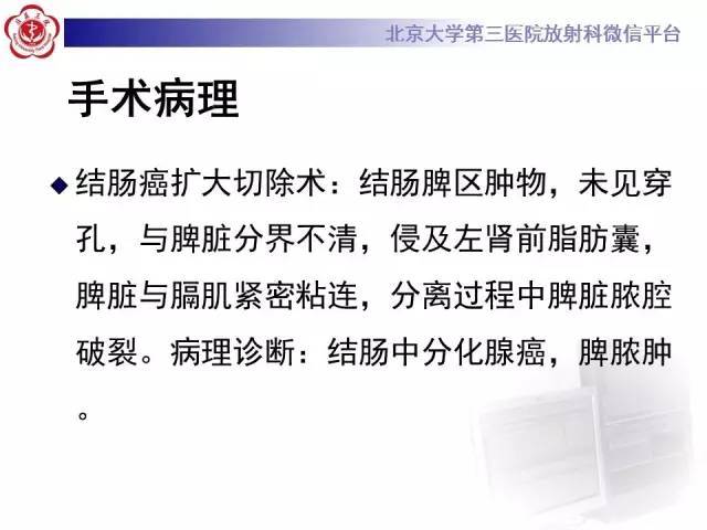 【病例】结肠癌继发脾脏脓肿1例CT