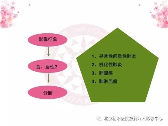 【三甲读片】这例看似肺炎的病变,多数人会误诊 【三甲读片】这例看似肺炎的病变,多数人会误诊