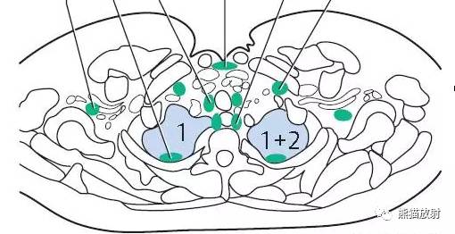 【解剖】肺叶、肺段分布简图（适用于X线、CT、MRI）