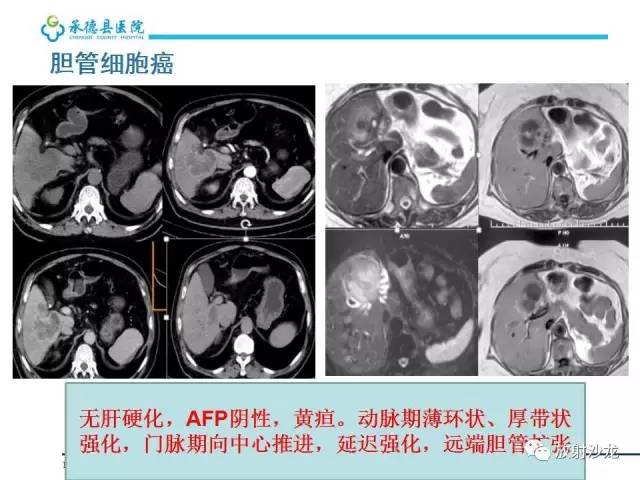 【PPT】肝脏常见占位性病变影像表现及诊断思路