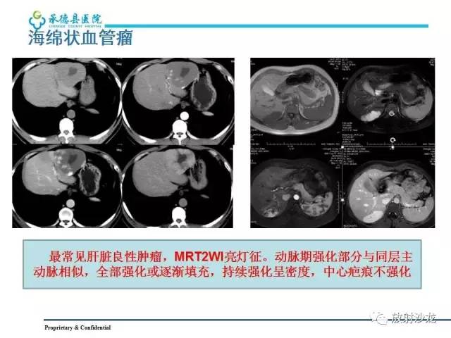 【PPT】肝脏常见占位性病变影像表现及诊断思路