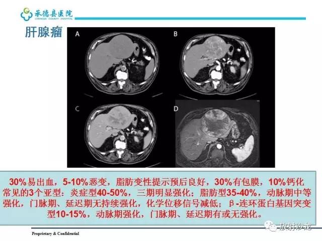 【PPT】肝脏常见占位性病变影像表现及诊断思路