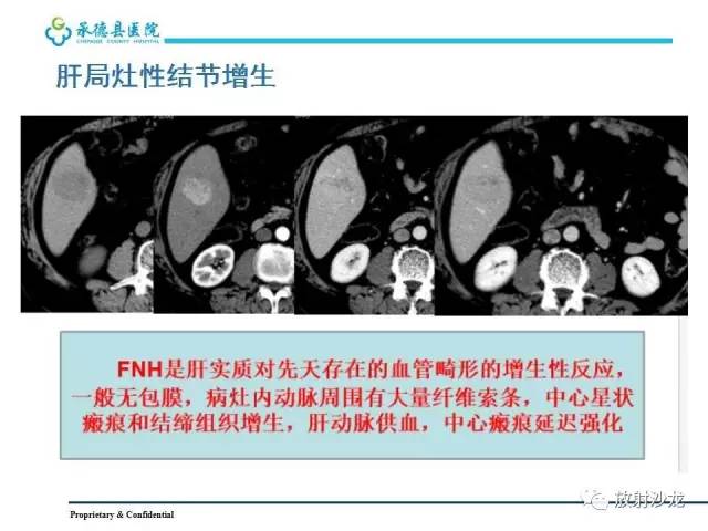 【PPT】肝脏常见占位性病变影像表现及诊断思路