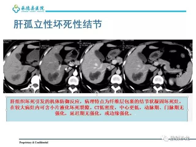 【PPT】肝脏常见占位性病变影像表现及诊断思路