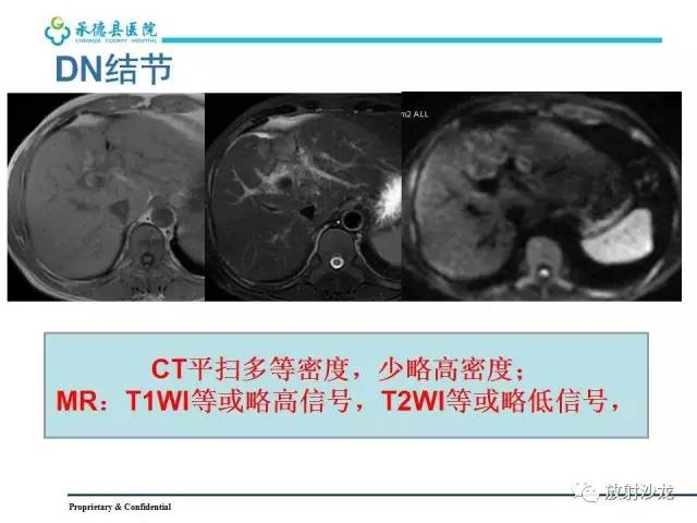 【PPT】肝脏常见占位性病变影像表现及诊断思路