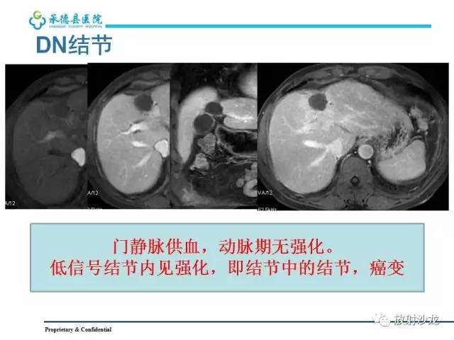 【PPT】肝脏常见占位性病变影像表现及诊断思路